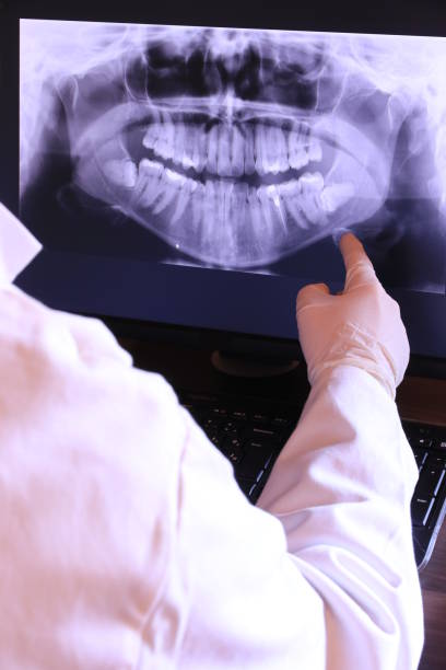 Best Emergency Treatment for Dental Infections or Abscesses in Mountain Lake Park, MD